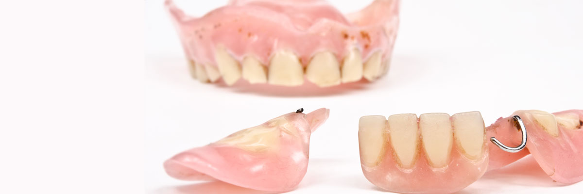 Many What Do I Do If I Damage My Dentures?