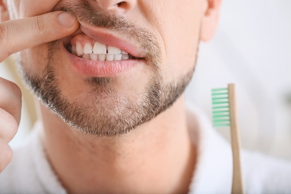 Easy Tips To Prevent Gum Disease